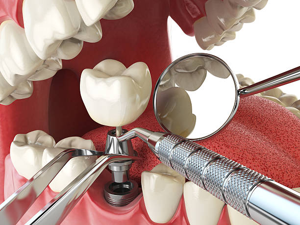Best After-Hours Emergency Dentist in Belle Chasse, LA